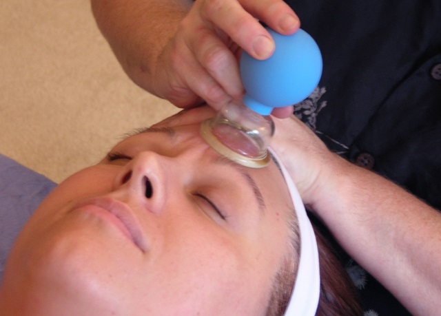 cupping3